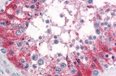 Immunohistochemistry-Paraffin: SRPX2 Antibody [NBP3-14484]